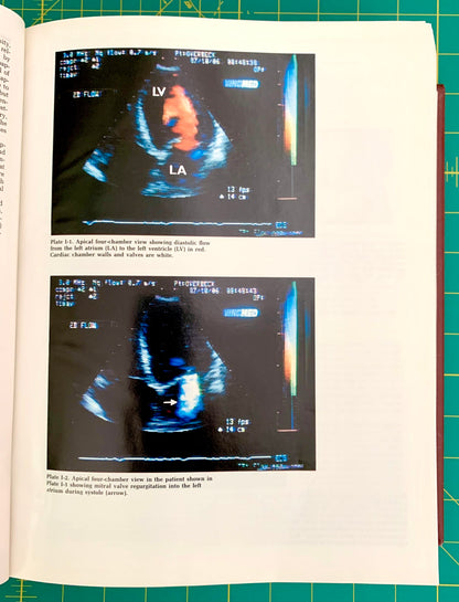 A printed medical ultrasound page shown in a book or notebook, featuring two black-and-white echocardiogram images with caption text on an off-white page, photographed against a green cutting mat background.
[additional_image_link]