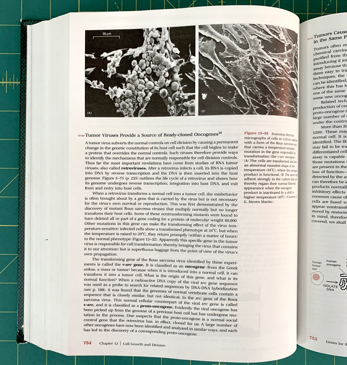An open book showing printed pages with a large historical photograph of a bacterium and text about Turner Vireus. The book is photographed on a green cutting mat with a pencil visible at the bottom.
[additional_image_link]