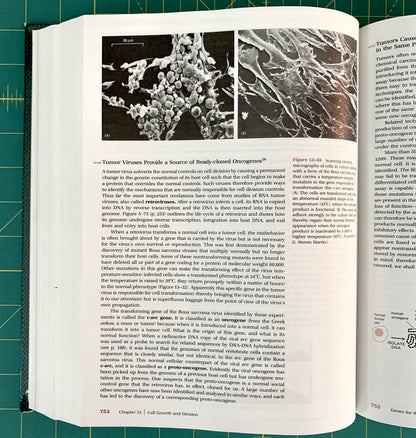 An open book showing printed pages with a large historical photograph of a bacterium and text about Turner Vireus. The book is photographed on a green cutting mat with a pencil visible at the bottom.
[additional_image_link]